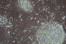 A stem cell colony